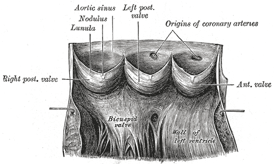 The aortic valve opened out, with the sinuses of Valsalva and the origins of the coronary arteries.