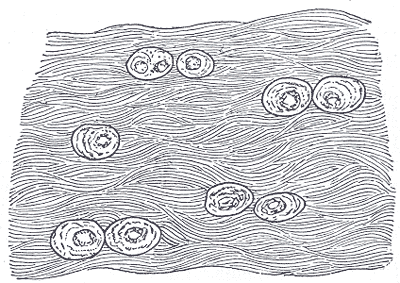 White fibrocartilage from an intervertebral disc, with chondrocytes set between dense collagen bundles.
